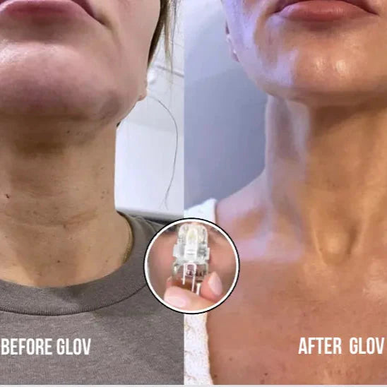 Micro Infusion Facial System