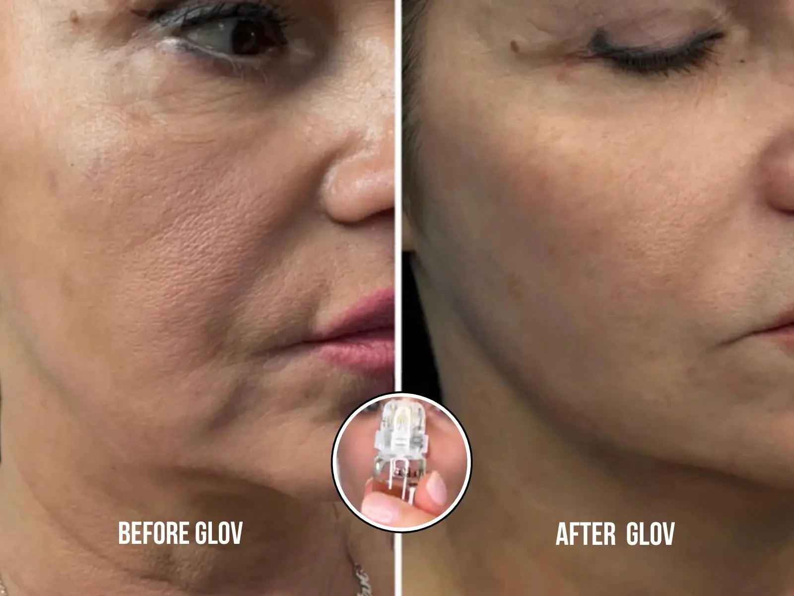 Micro Infusion Facial System